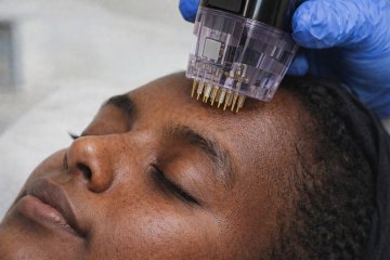 Skin Rejuvenation: A Glow Like Never Before